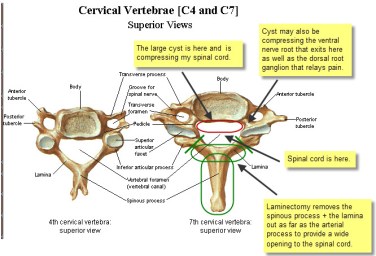 Cervical Vertebrae
