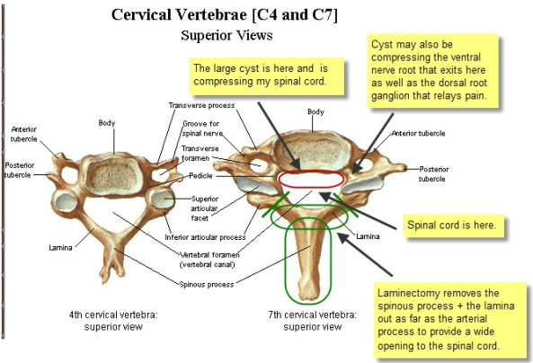 Cervical Vertebrae